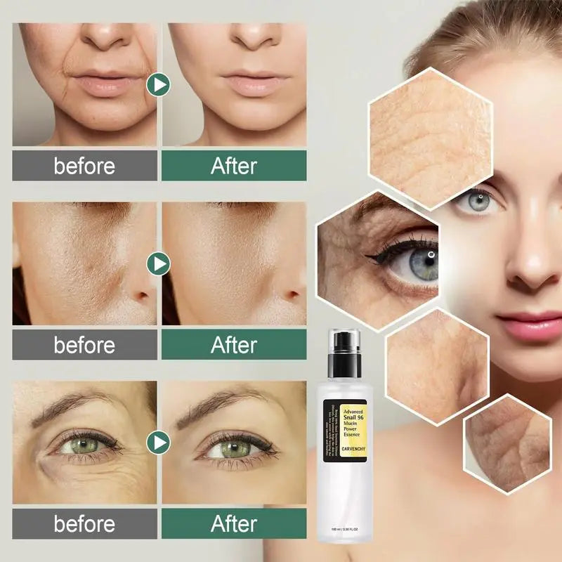 Snail Mucin 96.3% Snail Secretion Hyaluronic Acid 100 ml
